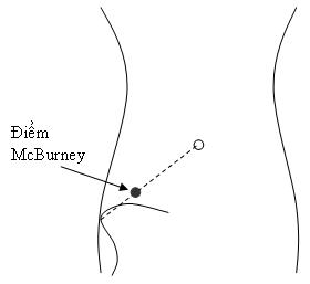 McBurney.JPG