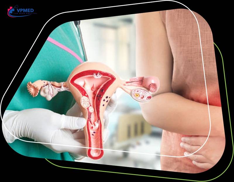 Khám sản phụ khoa là gì?