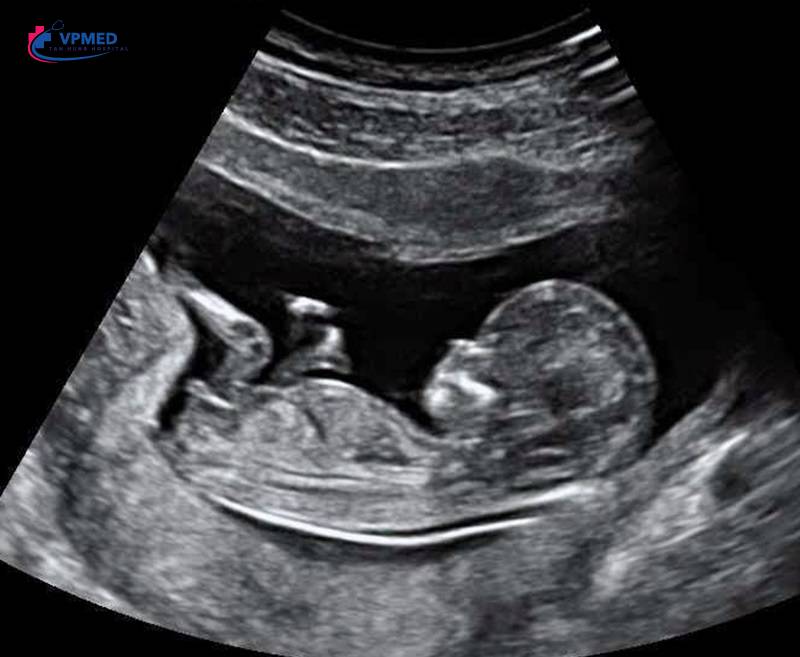 Các xét nghiệm trong 3 tháng đầu thai kỳ