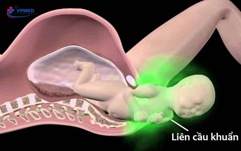 Các xét nghiệm trong 3 tháng giữa thai kỳ
