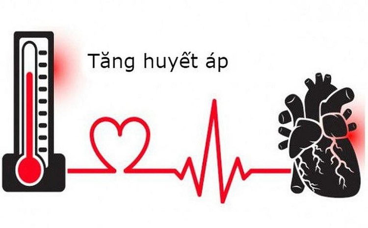 Tăng huyết áp là gì và vì sao cần điều trị?