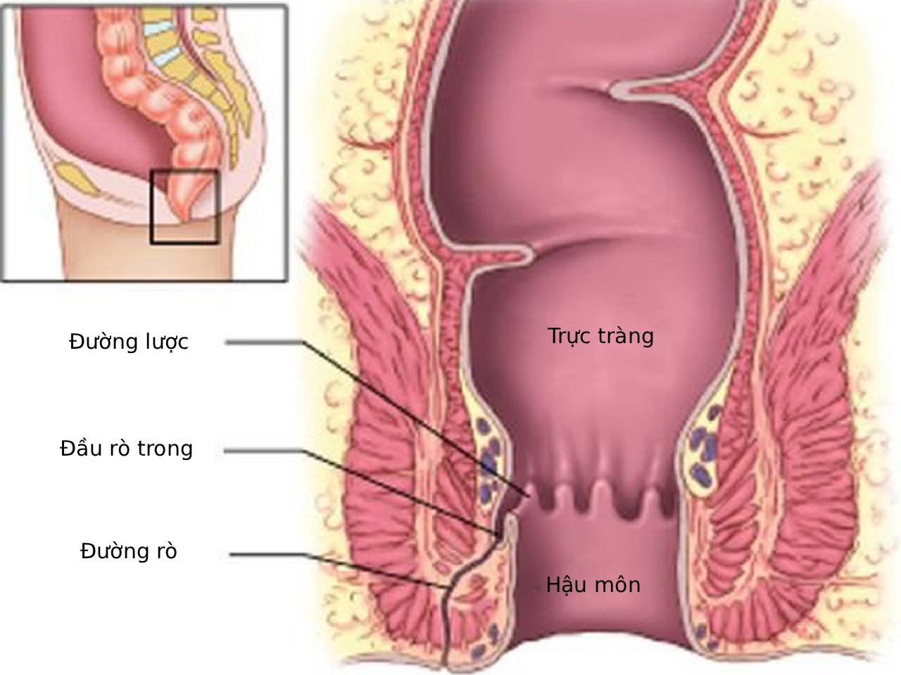 rò hậu môn câu chuyện khách hàng
